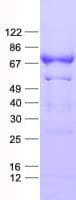 Human NXF2 Protein (Recombinant His, N-Terminal)