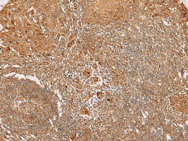 ABP-280 / FLNC Antibody