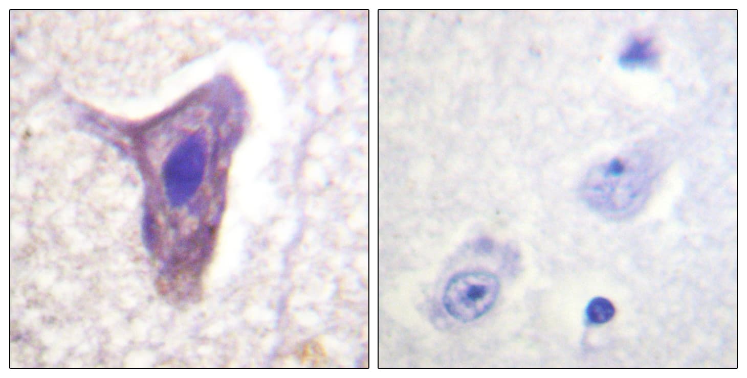 Polyclonal Rabbit anti-Human C5AR1 / CD88 / C5a Receptor Antibody (phospho-Ser338, IHC)