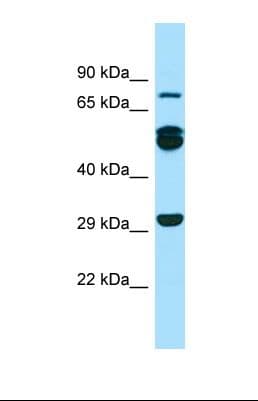 RAB11FIP1 Antibody (aa96-145)