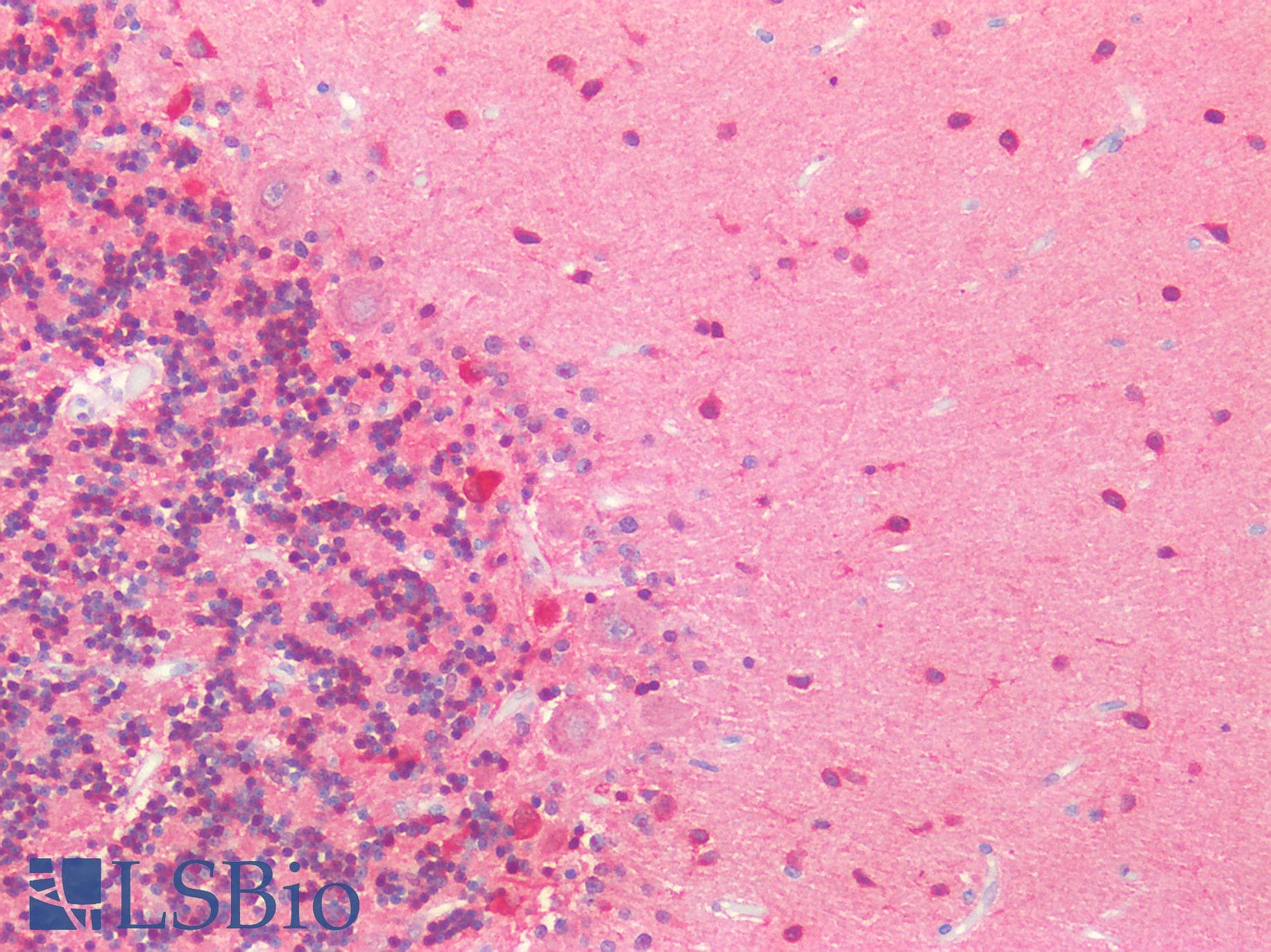 IHC-plus™ Polyclonal Rabbit anti-Human MAPT / Tau Antibody (pT548, IHC, WB)