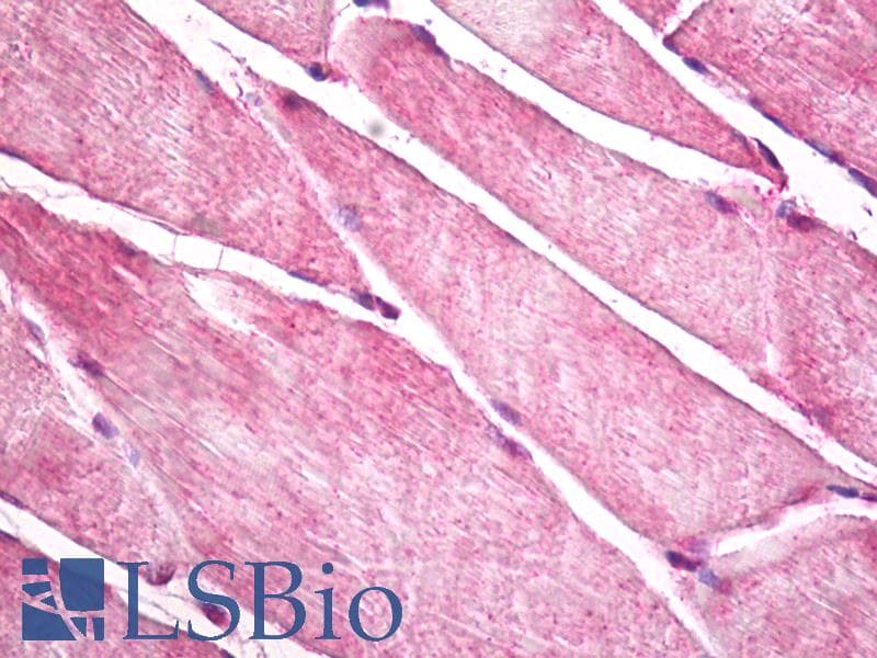 IHC-plus™ HACL1 Antibody