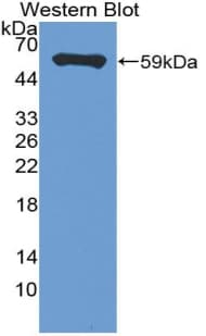 CD20 Antibody (aa8-251)