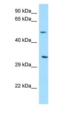 DPAGT2 / DPAGT1 Antibody (aa323-372)