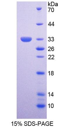 Human SMN1 Protein (Recombinant His-T7)