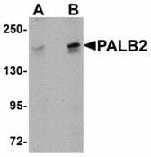 PALB2 Antibody