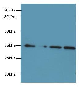 MRPL3 Antibody