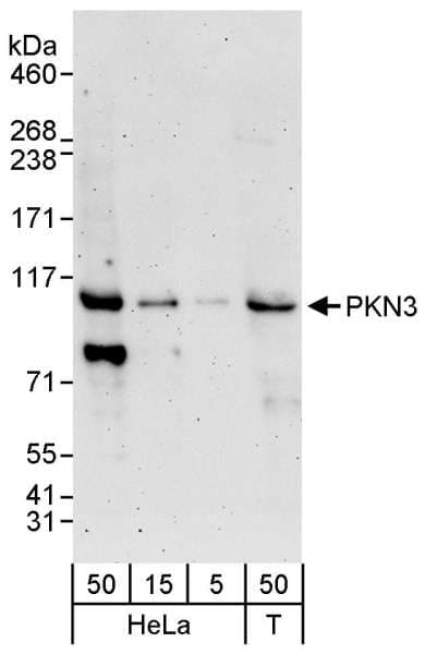PKN3 Antibody (aa225-275)