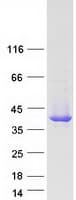Human SERPINB1 Protein (Recombinant Myc-DDK (Flag))