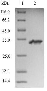 Rat SULT1A1 / Sulfotransferase 1A1 Protein (Recombinant 10His-SUMO, N-terminus + Myc, C-terminus)