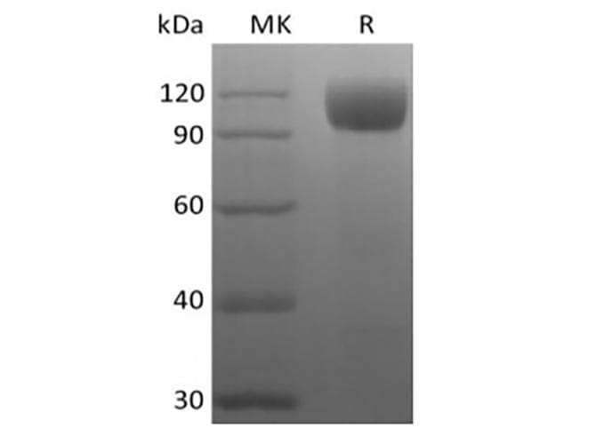 Rhesus monkey ACE2 / ACE-2 Protein (Recombinant 10His, C-terminus)