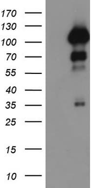 PR / Progesterone Receptor Antibody (aa1-298, clone OTI12D1)