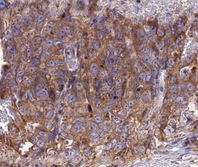 Polyclonal Rabbit anti-Human CCL5 / RANTES Antibody (IHC, WB)