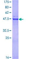 Human SIAH1 Protein (Recombinant GST)