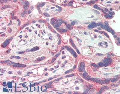 IHC-plus™ PD-L2 / PDCD1LG2 / CD273 Antibody (clone 8C12)