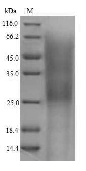 Mouse CR2 / CD21 Protein (Recombinant 6His, N-terminus)