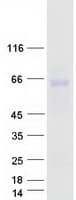 Human ZPLD1 Protein (Recombinant Myc-DDK (Flag))