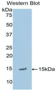 KRT1 / CK1 / Cytokeratin 1 Antibody (aa487-644, FITC)