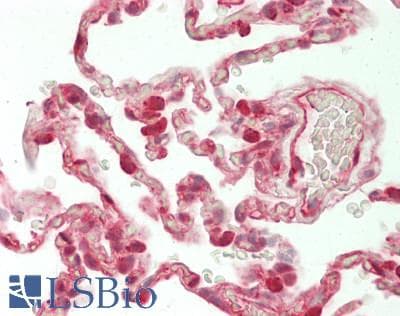 IHC-plus™ RELA / NFKB p65 Antibody (clone 8G3)