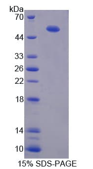 Human CHRDL1 Protein (Recombinant His-T7)