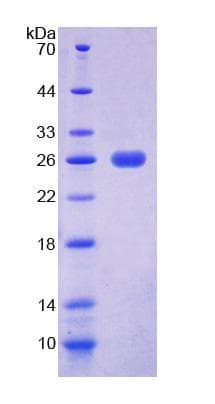 Human EEF2 / Elongation Factor 2 Protein (Recombinant His-T7)