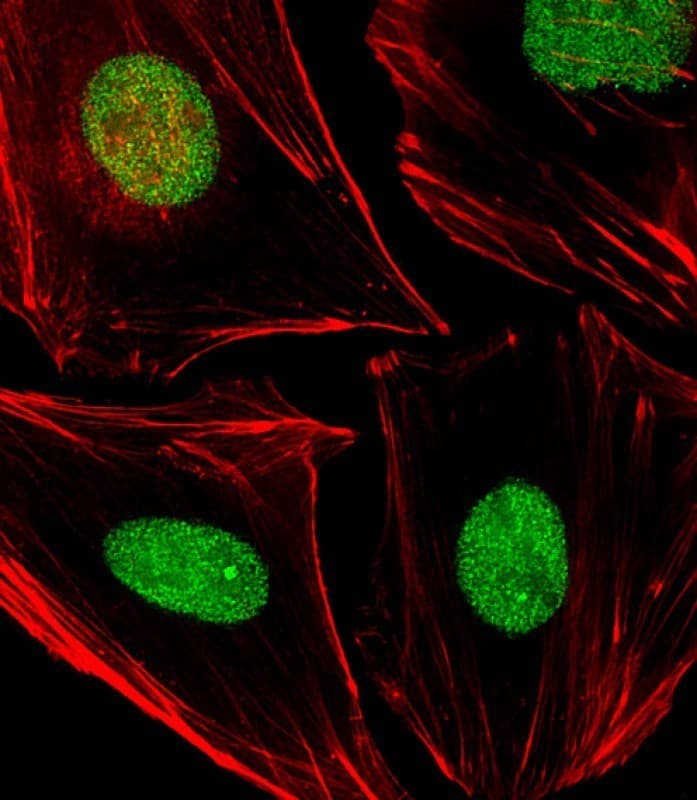 APEX1 / APE1 Antibody (clone 1518CT337.123.86.269.232)