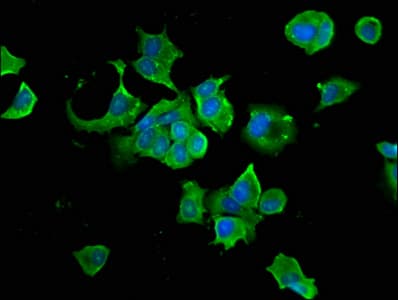 Polyclonal Rabbit anti-Human HSP90AB1 / HSP90 Alpha B1 Antibody