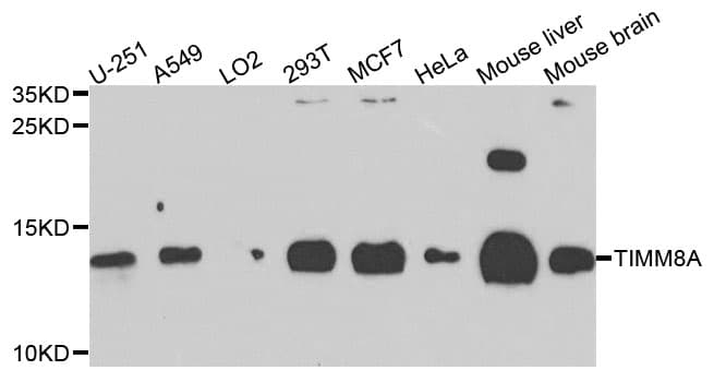 TIMM8A Antibody