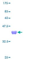 Human TXN / Thioredoxin / TRX Protein (Recombinant GST)