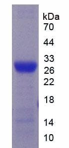 Mouse CYP2E1 Protein (Recombinant His)