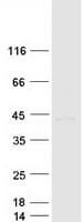 Human SOX1 Protein (Recombinant Myc-DDK (Flag))