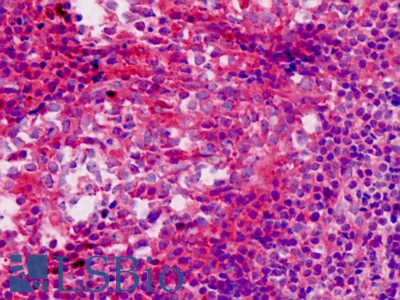IHC-plus™ SQSTM1 Antibody (aa383-409)