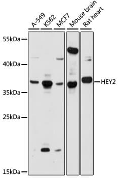 Polyclonal Rabbit anti-Human CHF1 / HEY2 Antibody (WB)