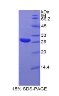 Rat GPC4 / Glypican 4 Protein (Recombinant His)