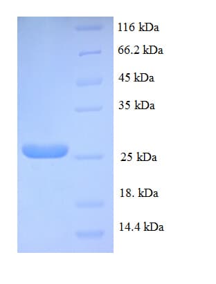 Human NRN1 / Neuritin Protein (Recombinant His-SUMO)