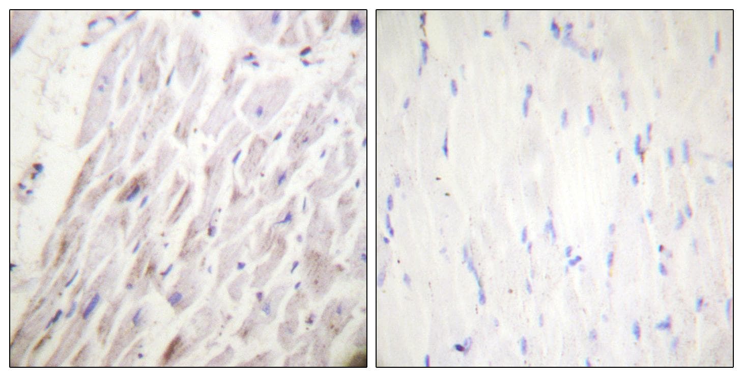DMTN / Dematin Antibody (phospho-Ser403)