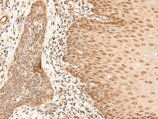 ARMC8 Antibody