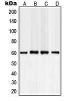 Polyclonal Rabbit anti-Human PLCG2 / PLC Gamma 2 Antibody (Internal, IHC, WB)