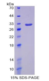 Mouse SIRPA / CD172a Protein (Recombinant His-T7)