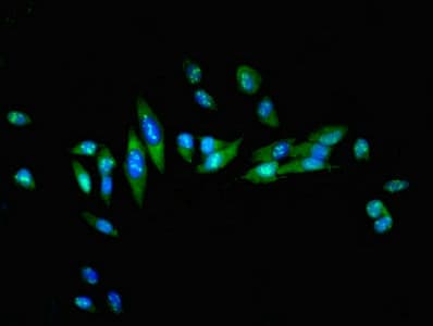 Polyclonal Rabbit anti-Human HSF1 Antibody (IHC, IF, WB)