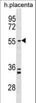 PAPD5 Antibody (aa1-30)