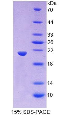 Human PANX1 / Pannexin 1 Protein (Recombinant His-T7)