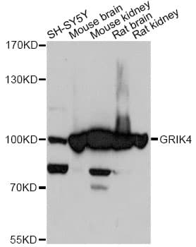 GRIK4 / KA1 Antibody