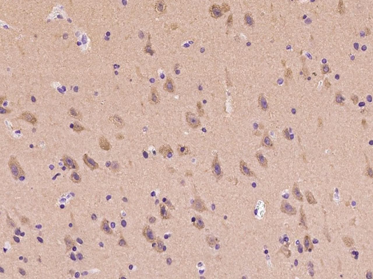 MAPRE3 / EB3 Antibody
