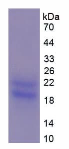 Human PMP22 Protein (Recombinant His-T7)