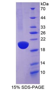 Human ACE / CD143 Protein (Recombinant His-T7)