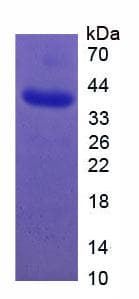 Human SLC2A2 / GLUT2 Protein (Recombinant His-GST, N-terminus)