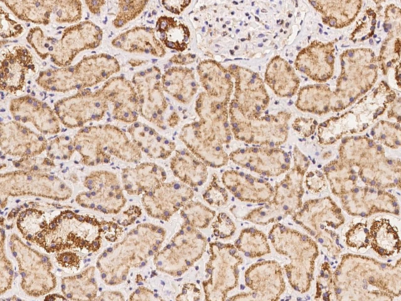 ST14 / Matriptase Antibody