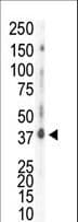 CSNK1D Antibody (aa321-352)
