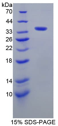 Human AKAP11 / KIAA0629 Protein (Recombinant His-T7)